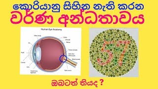 Color Blind test sinhala වර්ණ අන්ධතාවය [upl. by Riana]