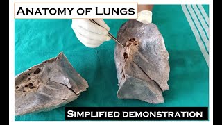 Anatomy of Lungs  Simplified demonstration by Dr Ashok Kumar J Made easy for 1st year medicos [upl. by Odette]