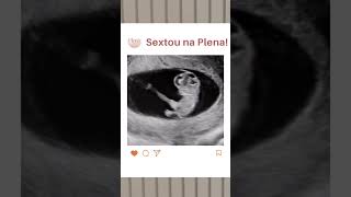 Gestação 9 semanas gestacaosaudavel ultraobstetrica ultrassomgestacional embriao [upl. by Nirok707]