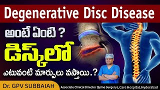 What is degenerative disc disease DDD   What happens in the disc in DDD  Dr GPV Subbaiah [upl. by Topliffe]