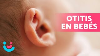 OTITIS en BEBÉS 👶🏻👂🏻  Síntomas Tratamiento y Cómo Prevenirla ✅ [upl. by Risley]