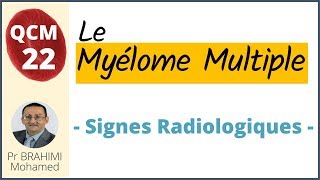 Myélome Multiple Signes Radiologiques  Hématologie QCM 22 [upl. by Faludi]