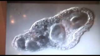 Amoeba eats two paramecia Amoebas lunch HARLEM SHAKE EDITION [upl. by Cohin]