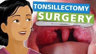 Tonsillectomy Surgery [upl. by Inihor847]