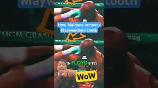 PUNCHED THAT REMOVES TOOTH  Mayweather vs Maidana boxing highlights boxingmatch floyd [upl. by Hnahc452]