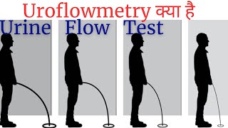 Uroflowmetry test in Hindi  urine flow test explained  Uroflowmetry test kaise hota hai [upl. by Dragde275]