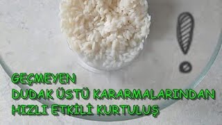 DUDAK ÜSTÜ KARARMALARINA SON 🚫 MUCİZE MASKE  Köy Yolum [upl. by Sivla]