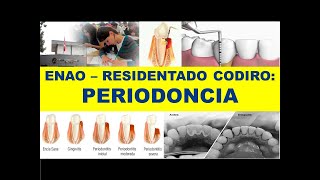 ENAO  RESIDENTADO ODONTOLÓGICO PERIODONCIA [upl. by Einnahc891]