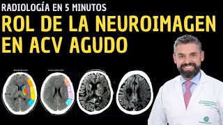 Radiología en 5 minutos Rol de la neuroimagen en ACV agudo [upl. by Ettennil911]