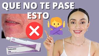 Lo que DEBES saber al INICIAR con TRETINOINA y tener ÉXITO ⭐ Método de 5 fases [upl. by Ytsenoh]