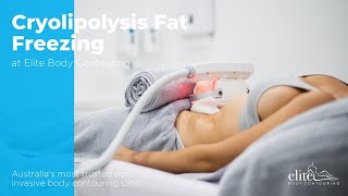 Cryolipolysis Fat Freezing [upl. by Teodora744]