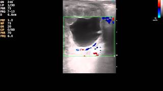 Color Doppler Ultrasound of a 20 day equine pregnancy [upl. by Wildee]