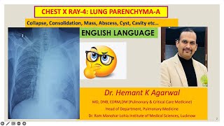 Radiology Chest X Ray4 ENGLISH Collapse Consolidation Mass AbscessDr Hemant K Agarwal [upl. by Terriss]