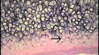 Cartilage and Bone Histology FreeMedEd [upl. by Josephina]