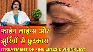 झुर्रियों से बचाव और ईलाज  Treatment of Wrinkles amp Fine Lines In HINDI [upl. by Avrit]