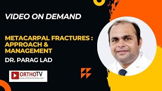 Metacarpal Fractures  Approach amp Management  Dr Parag Lad [upl. by Lucille]