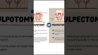 Difference between pulpotomy and pulpectomy dental dentistry dentistrystudent doctor dentist [upl. by Ulrick]