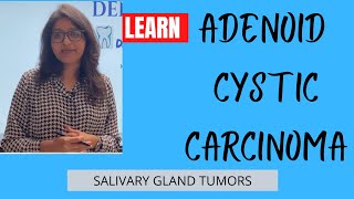 ADENOID CYSTIC CARCINOMA I SALIVARY GLAND TUMORS I BDS I MBBS [upl. by Araminta440]