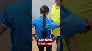 Scoliosis treatment by DrRajneesh kant [upl. by Neumeyer104]