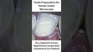 microscopicdentistry dentistinkarnal drneerajnarang bestdentistry [upl. by Minne]