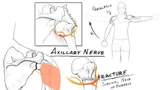 The Brachial Plexus II Animated Review HD [upl. by Lefty]