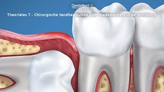 Theorieles 7  Chirurgische tandheelkunde voor medewerkers in de mondzorg [upl. by Ainnek]