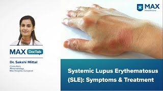 Systemic Lupus Erythematosus SLE Symptoms amp Treatment  Dr Sakshi Mittal  Max Gurugram [upl. by Hashum]