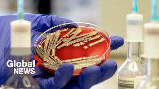 E coli outbreak How to protect yourself from bacteria infection [upl. by Nyvlem]