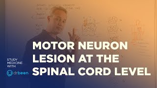 Motor Neuron Lesions at the Spinal Cord Level  Upper And Lower Motor Neuron Deficit [upl. by Homans]