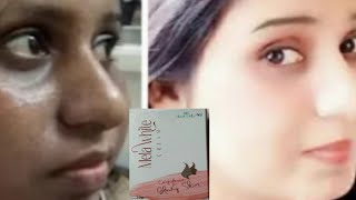 VIDEO  होली में गोरा होने का कमाल बेस्ट स्क्रीन क्रीमMela White Cream Honest Review [upl. by Eveneg323]