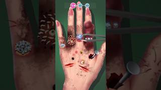 Hand Clin Doctor  Tile Blast [upl. by Ori]