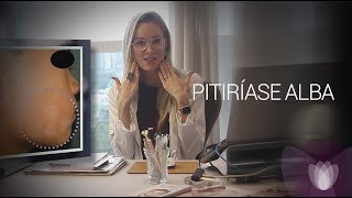 PITIRÍASE ALBA  Dra Gabriela Schaefer  Dermatologista [upl. by Idette]