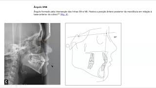 Aula de Cefalometria [upl. by Os]