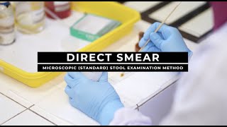 Direct Smear  Microscopic Standard Stool Examination Method [upl. by Aym]