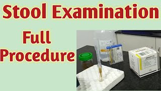 Stool examination  Stool microscopic examination  Stool examination in hindi Stool test procedure [upl. by Ahsinotna]