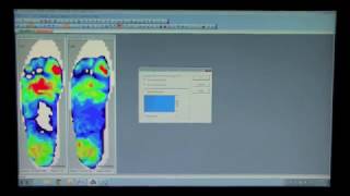 FScan™ Demonstration at the NY Podiatry Conference 2014 [upl. by Augustus]