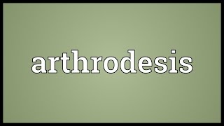 Arthrodesis Meaning [upl. by Beedon]