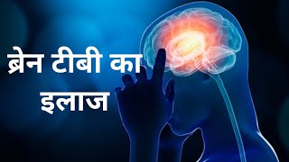 BRAIN TB  TB Meningitis  Tuberculoma  ब्रेन टीबी [upl. by Atikal]