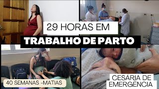 PARTO CESÁRIA PELO SUS  TENTEI NORMAL [upl. by Ecirpac492]