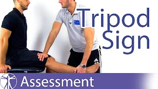 Tripod Sign  Hamstring Contractures [upl. by Marou]