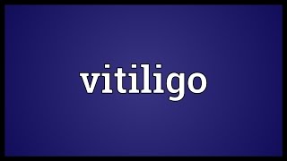 Vitiligo Meaning [upl. by Publia]