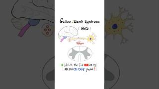 GuillainBarré Syndrome GBS  Part 2…anatomy biology science neuroscience nurse doctor [upl. by Ahsinna]