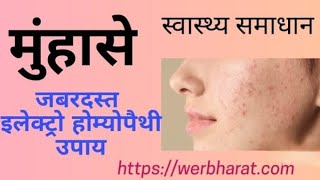 PIMPINELLA SAXIFRAGA पिप्पीनेला सैक्सीफ्रॉगा ELECTROHOMEOPATHY PHARMACY CLASS [upl. by Kendricks]