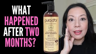 HAIR LOSS SUFFERER TESTS PURA DOR PROFESSIONAL BIOTIN SHAMPOO 8 WEEK REVIEW WITH BEFORE AND AFTER [upl. by Atinrahc]