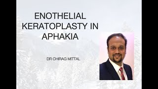 ENDOTHELIAL KERATOPLASTY IN APHAKIA  EYE TODAY Webinar talk  Dr Chiraj [upl. by Haymes]