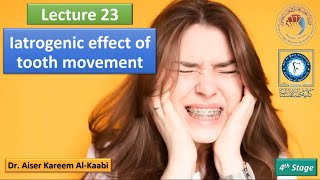 Iatrogenic effect of tooth movement lec23 تقويم الأسنان للمرحلة الرابعة [upl. by Ariahaj]