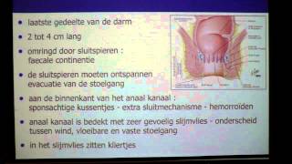 Haarnestcyste  proctologie  Dr Tom Feryn [upl. by Sera]