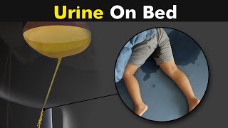 Why Childs and some adults do urine on bed  Bedwetting  Causes and treatment UrduHindi [upl. by Goth]