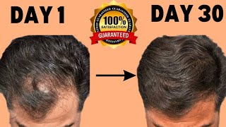 STOP HAIR FALL NATURALLY  HOME REMEDIES TO REDUCE HAIR FALL  HAIR REGROWTH TIPS  FAST HAIR GROWTH [upl. by Japha383]