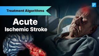 The Shocking Truth About Stroke Management No Doctor Tells You [upl. by Airtemak55]